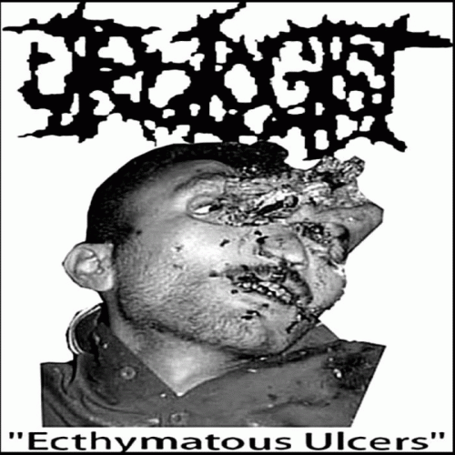 Urologist : Ecthymatous Ulcers